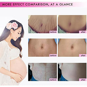 YG LianKai in maternity setting showing gentle care benefit