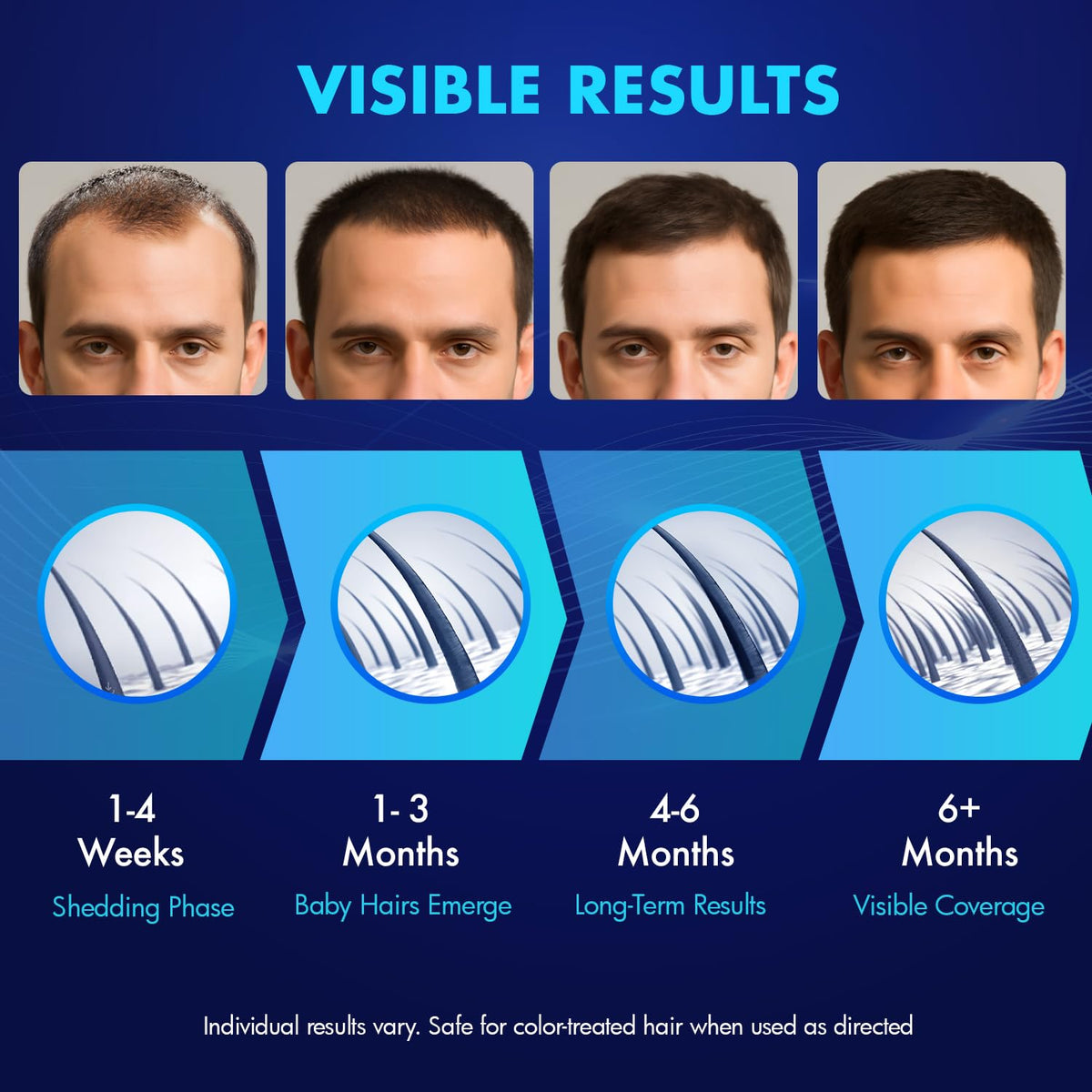 YIIORAUP hands applying solution to thinning area demonstrating easy, targeted use