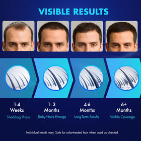 YIIORAUP hands applying solution to thinning area demonstrating easy, targeted use