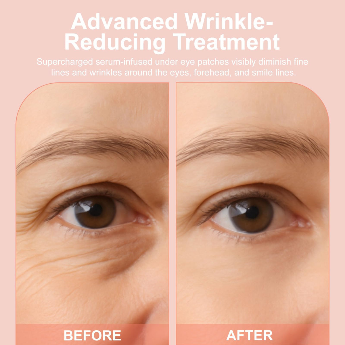 YLOTRE ingredient label close-up highlighting retinol, hyaluronic acid, collagen