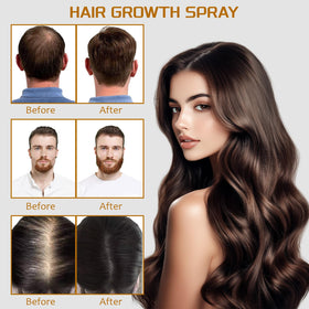 YOUNGYOUNGLOVE applying spray to scalp to target thinning areas effectively