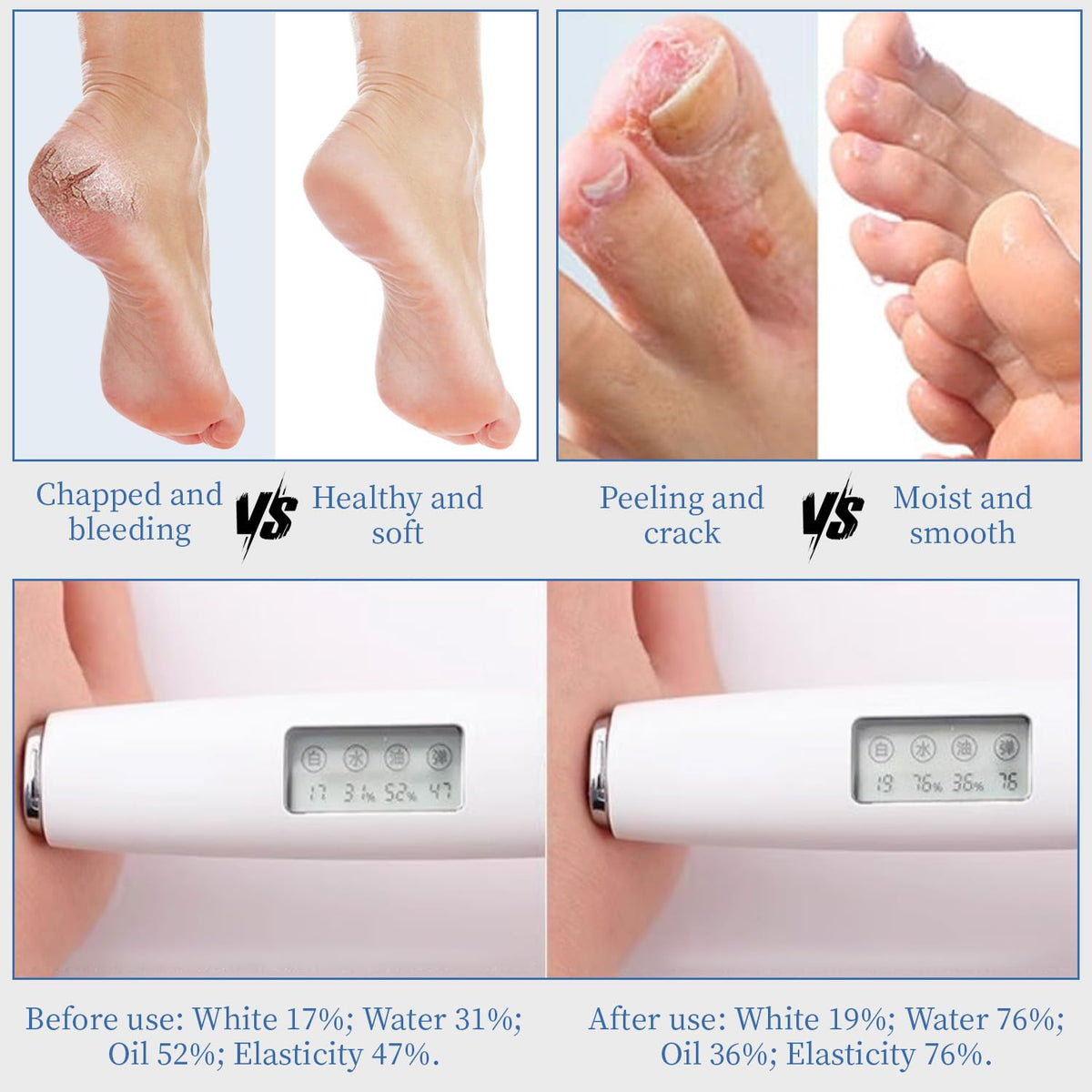 YOUNGYOUNGLOVE nighttime use on feet under socks for intensive repair