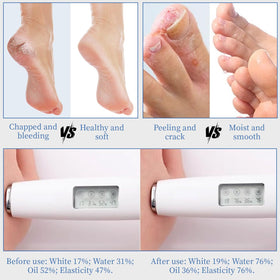 YOUNGYOUNGLOVE nighttime use on feet under socks for intensive repair