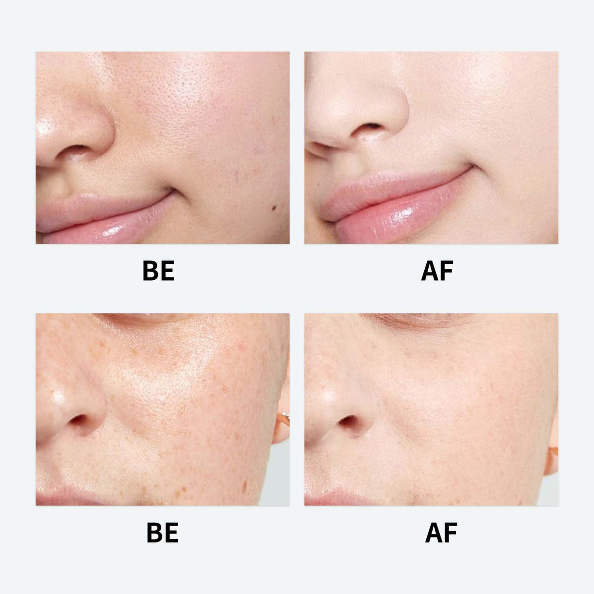 Youthful Formula Ultimate cream on fingers illustrating easy application and quick absorption