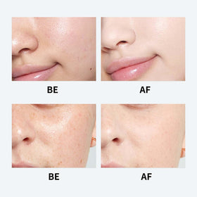 Youthful Formula Ultimate cream on fingers illustrating easy application and quick absorption