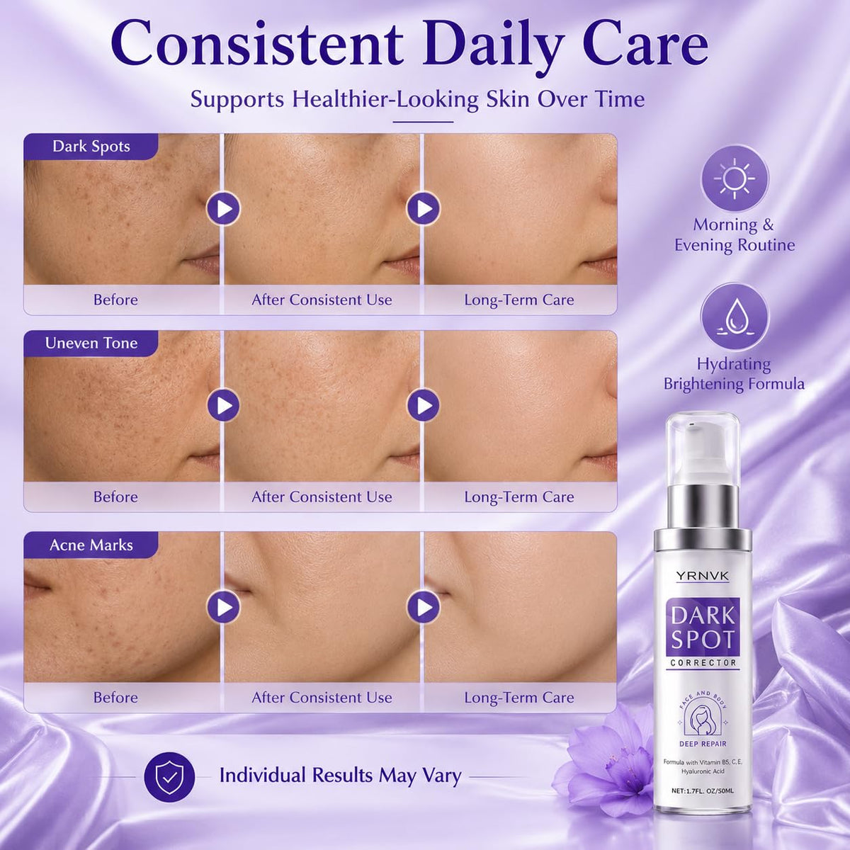 YRNVK applying serum on hands showing body spot treatment benefit