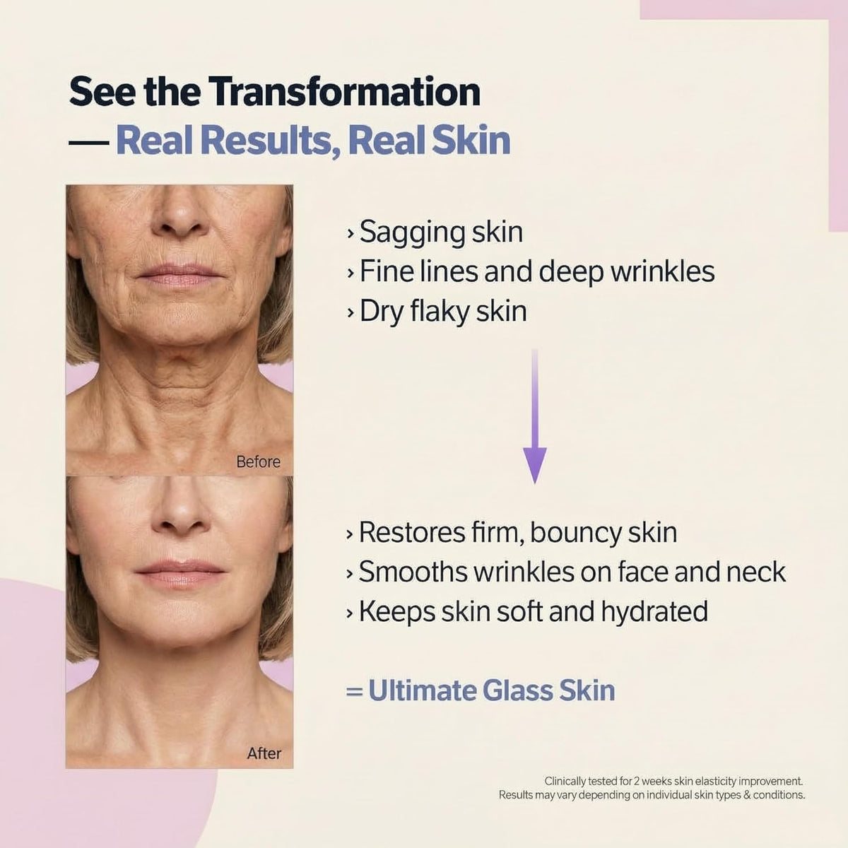 YTDB applied on neck showing lifted jawline benefit