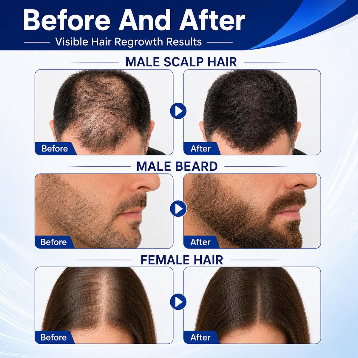 YUEJOIKL serum drop on scalp highlighting lightweight quick absorption