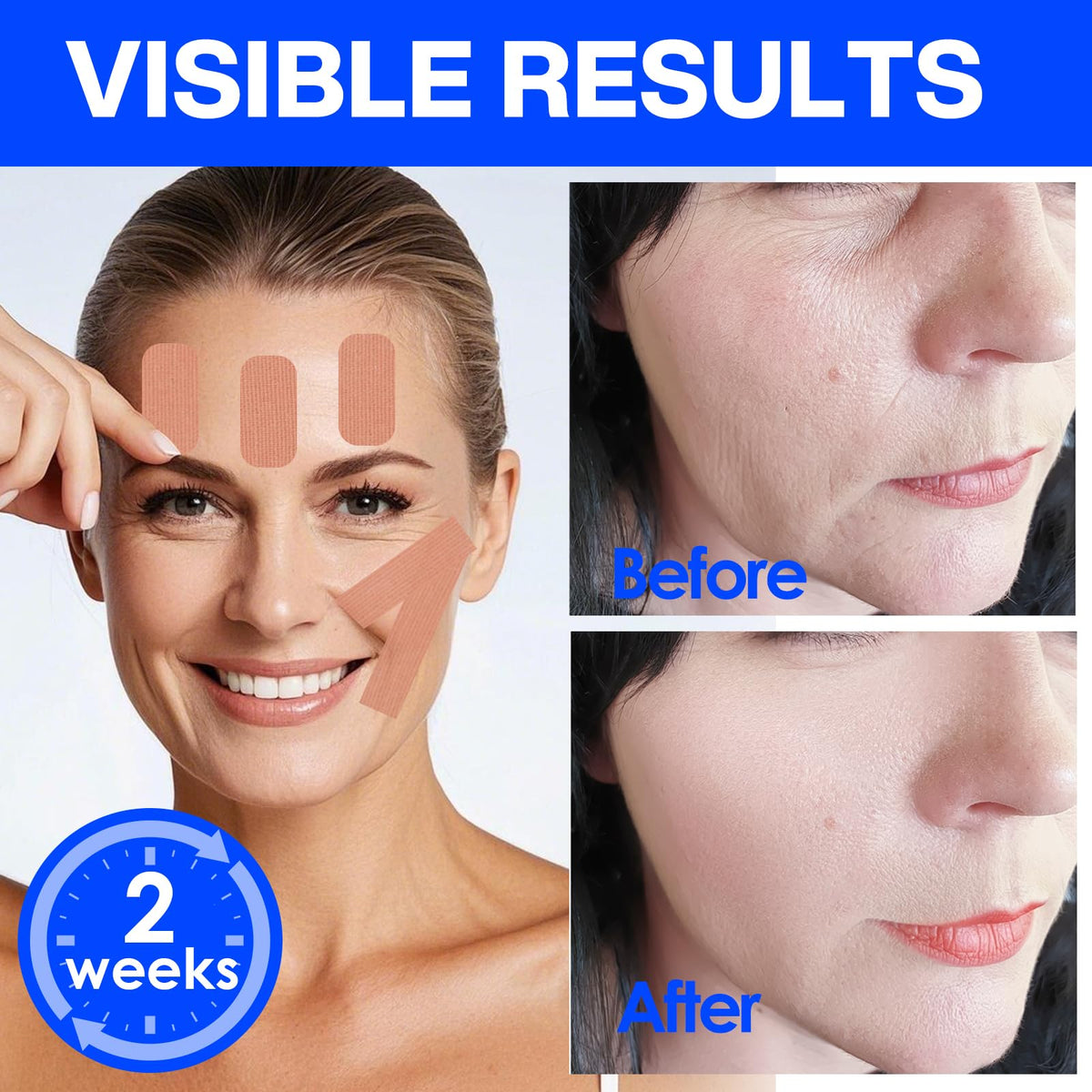 zancony tape applied on forehead overnight, lift and wrinkle support benefit