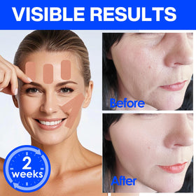zancony tape applied on forehead overnight, lift and wrinkle support benefit