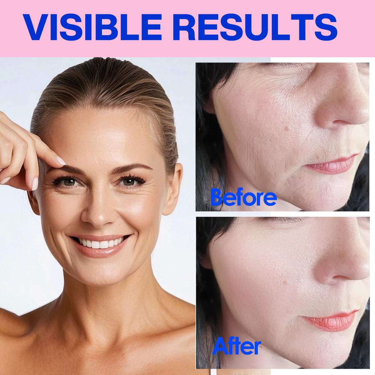 zancony tape applied to forehead overnight demonstrates gentle smoothing benefit