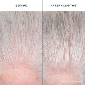 Zenagen in-use by model styling hair for natural-looking density