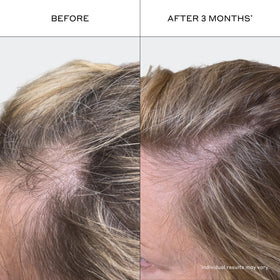 Zenagen Revolve styling comparison showing fuller-looking hair after use