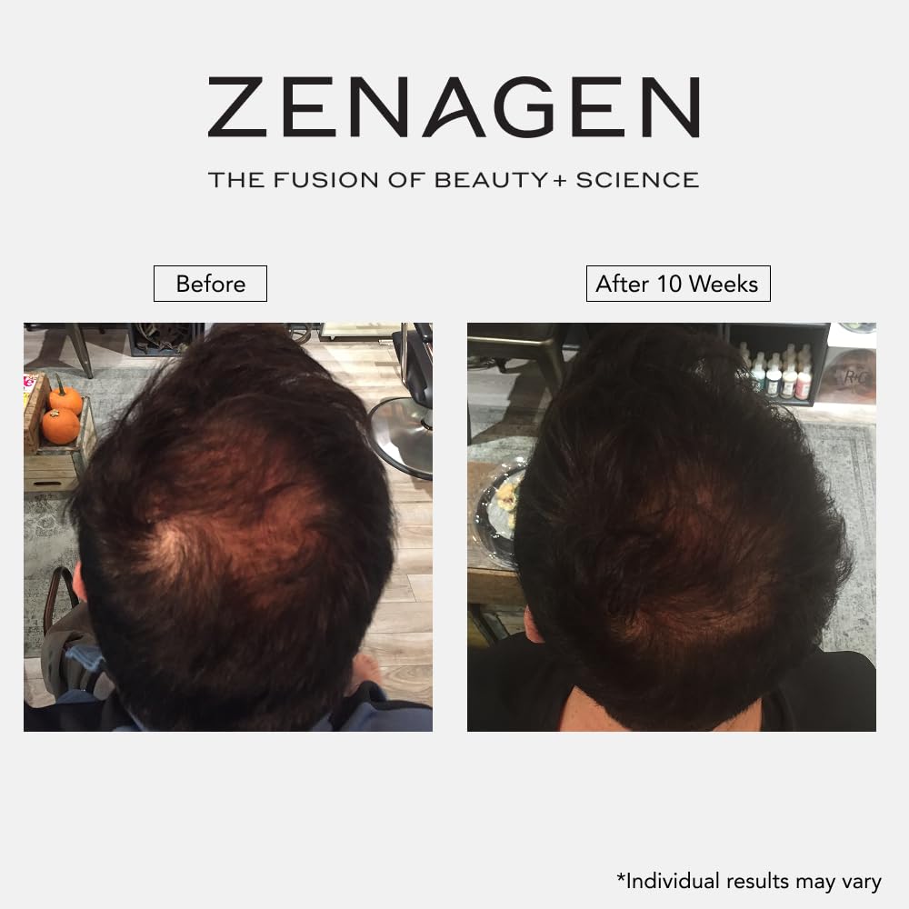 Zenagen Revolve in-shower application on wet hair for refreshed scalp benefit