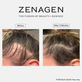 Zenagen Revolve bottles on a bathroom shelf for daily routine inspiration