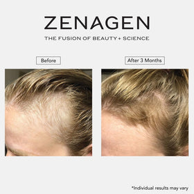 Zenagen Revolve compared to everyday item showing 200 mL size benefit
