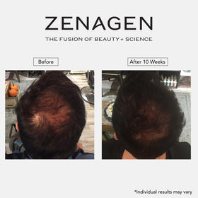 Zenagen Revolve bottle held in hand for scale, reveals true 473 mL size and travel-friendly benefit