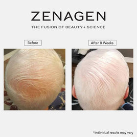 Zenagen Revolve styled hair after use showing fuller-looking results benefit