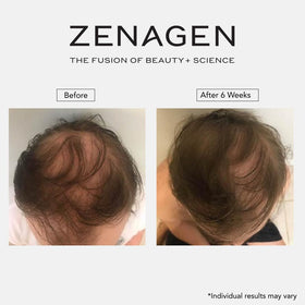 Zenagen Revolve result on styled hair, displays improved texture and denser-looking appearance benefit