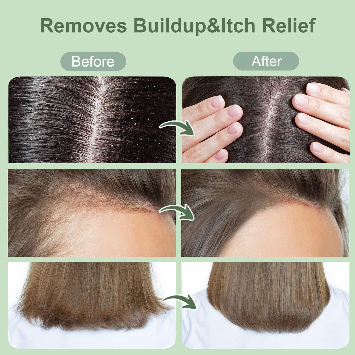 ZENGYQI applying scrub to a wet scalp demonstrating easy use