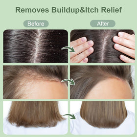 ZENGYQI applying scrub to a wet scalp demonstrating easy use