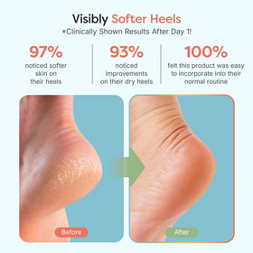 ZenToes open-toe design detail providing breathability and overnight comfort