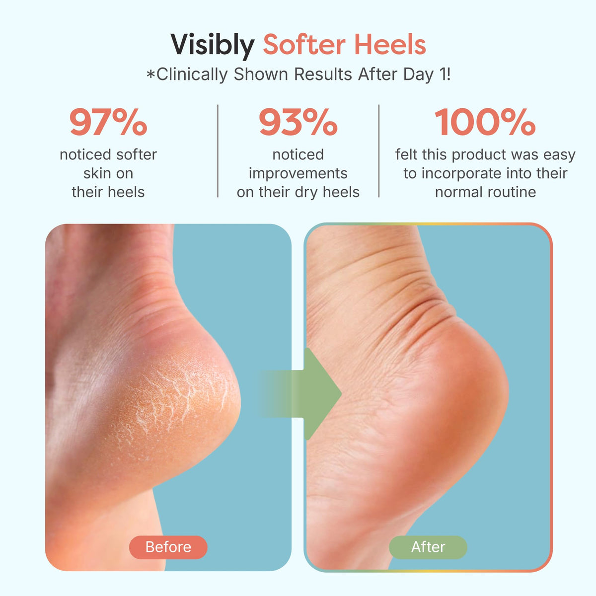 ZenToes open toe design detail promoting breathability and comfort