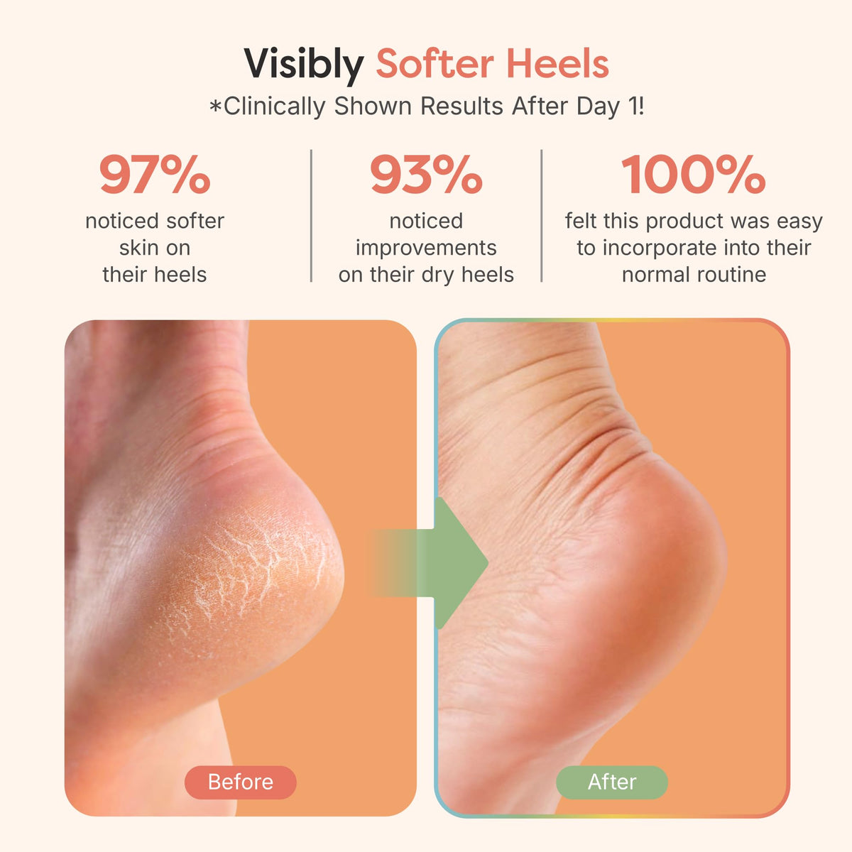 ZenToes open-toe detail showing breathable design benefit