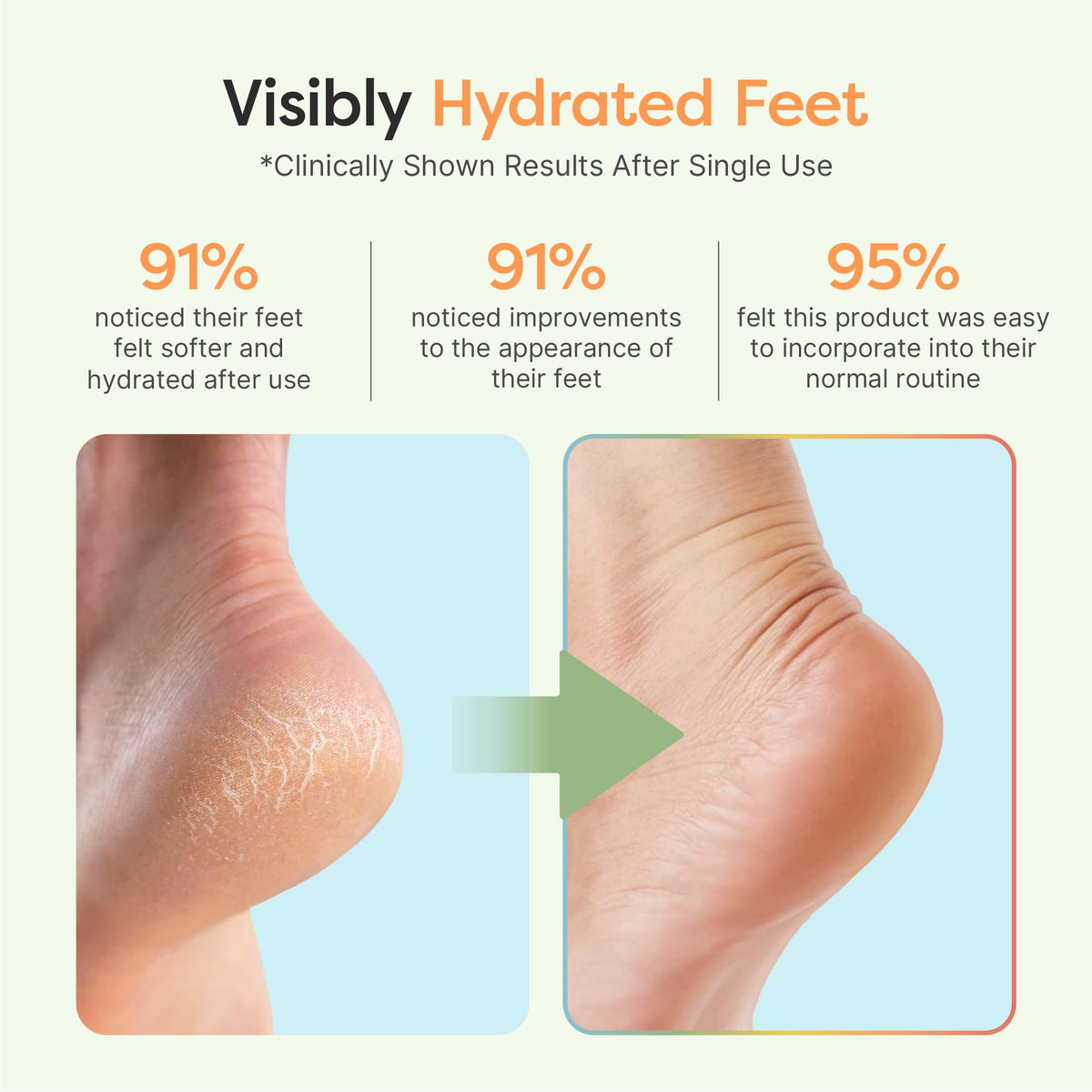 ZenToes open-toe design pictured on foot for breathable comfort