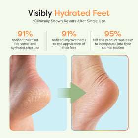 ZenToes open-toe design pictured on foot for breathable comfort