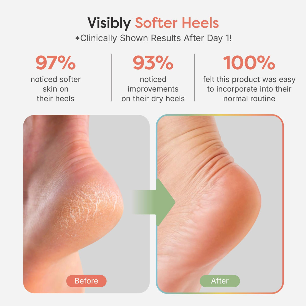 ZenToes open-toe detail, breathable design keeps toes free for comfort