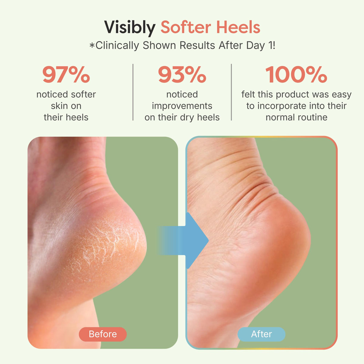 ZenToes open-toe sock detail demonstrating breathable fit