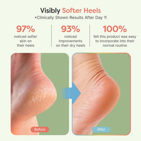 ZenToes open-toe sock detail demonstrating breathable fit