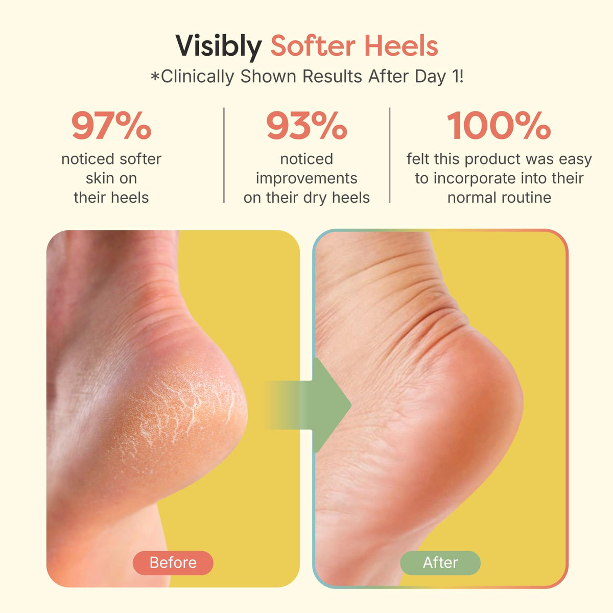 ZenToes open-toe design detail highlighting breathability and comfortable wear benefit