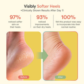 ZenToes open-toe design detail highlighting breathability and comfortable wear benefit