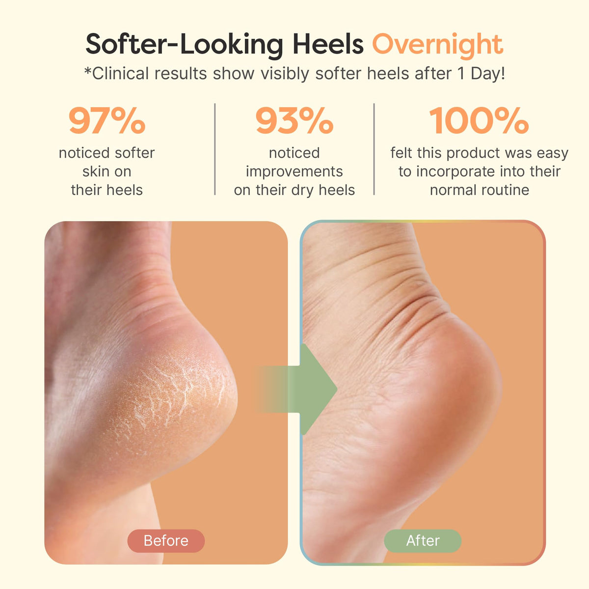 ZenToes open-toe design top view for breathable comfortable wear