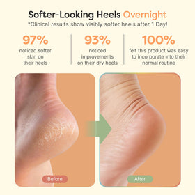 ZenToes open-toe design top view for breathable comfortable wear