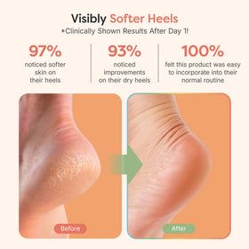 ZenToes open-toe design on foot demonstrating breathable comfort