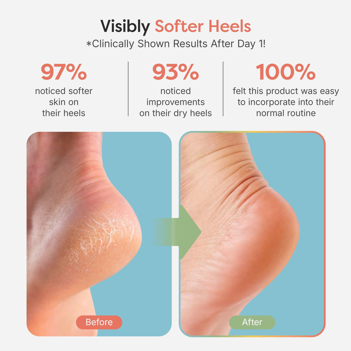ZenToes open toe detail highlighting breathability and toe comfort