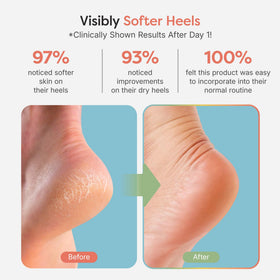 ZenToes open toe detail highlighting breathability and toe comfort