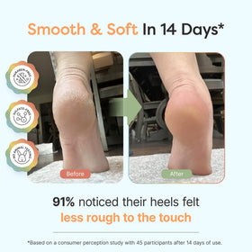 ZenToes cream texture close-up demonstrating smooth fast-absorbing finish