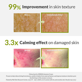 Hand applying ZEROID cream to back of hand showing smooth non-greasy absorbency