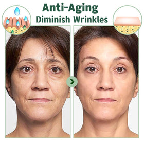 zhnnt applied on face overnight demonstrating wash-free absorption benefit