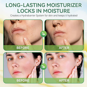 ZIIDII massaging balm into hands and elbows, restores softness to dry rough skin