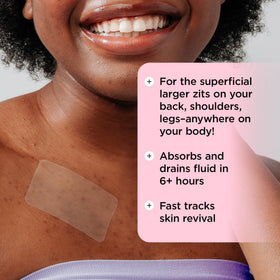 ZitSticka large body patch on shoulder providing coverage and calming effect