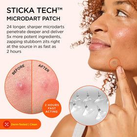 ZitSticka close-up of a circular patch highlighting adhesive and shape for secure wear
