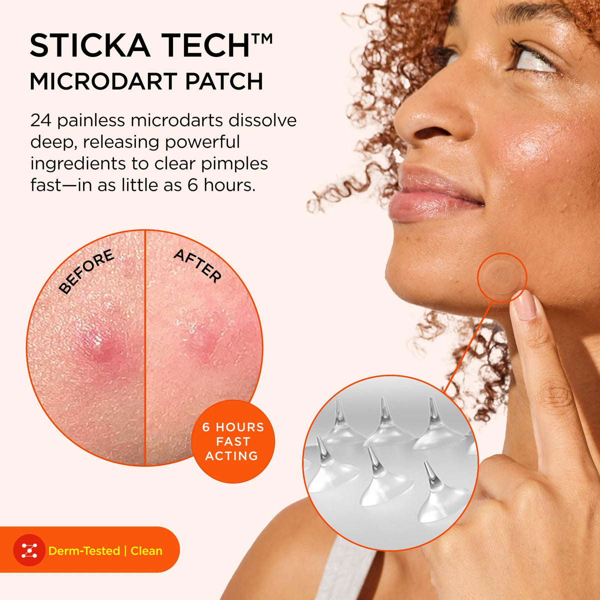ZitSticka close-up of clear patch highlighting its thin, discreet design