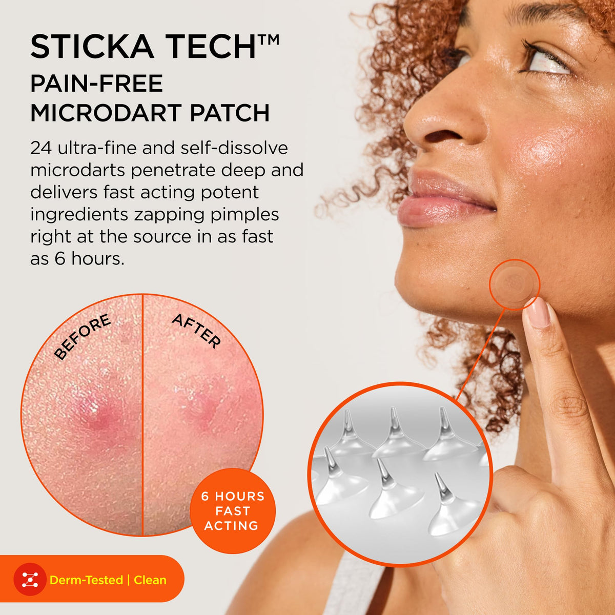 ZitSticka KILLA patch close-up revealing discreet surface and adhesive benefit