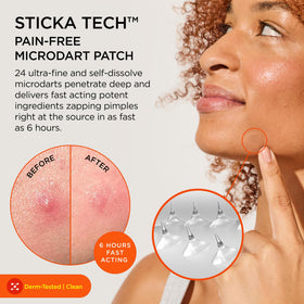 ZitSticka KILLA patch close-up revealing discreet surface and adhesive benefit