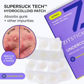 ZitSticka patch next to coin for size comparison and discreet wear